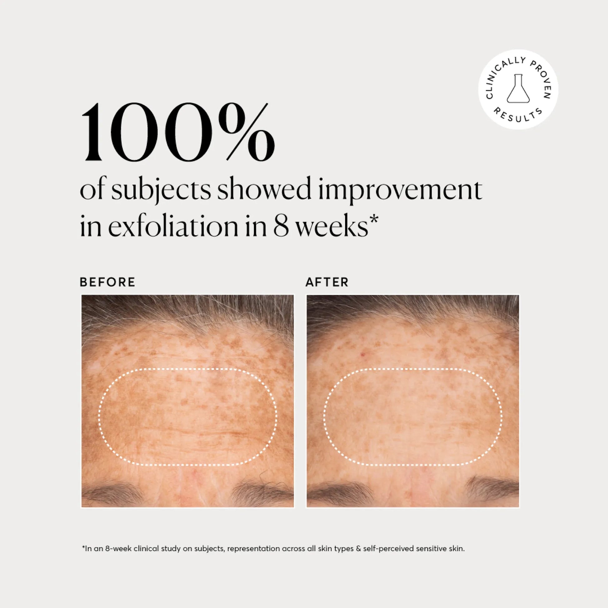 bha-liquid-exfoliant-2-w0 NATR-10027-Alt-Images-BHA-Liquid-Exfoliant-2_-03.webp