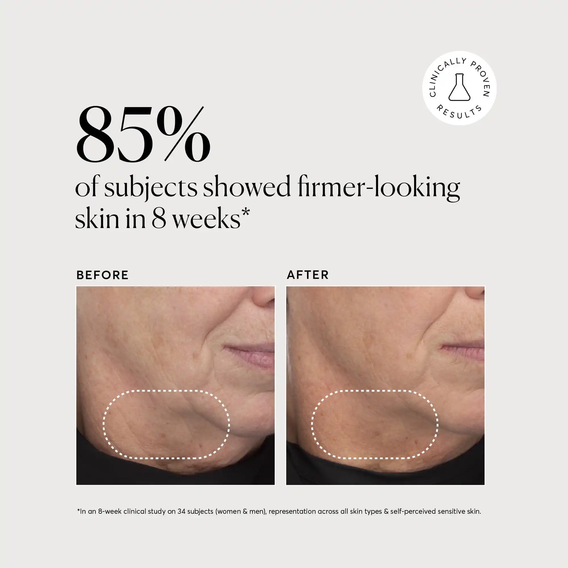 retinol-complex-serum-y6 NATR-10034-Alt-Images-Retinol-Complex-Serum-04.webp